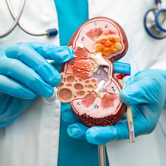 Adoctor holding a kidney model